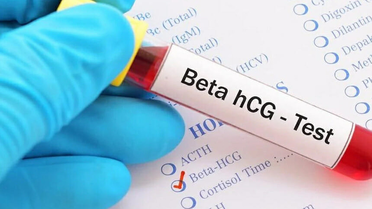 Beta HCG Testi: Hamilelik teşhisinde anahtar değerler