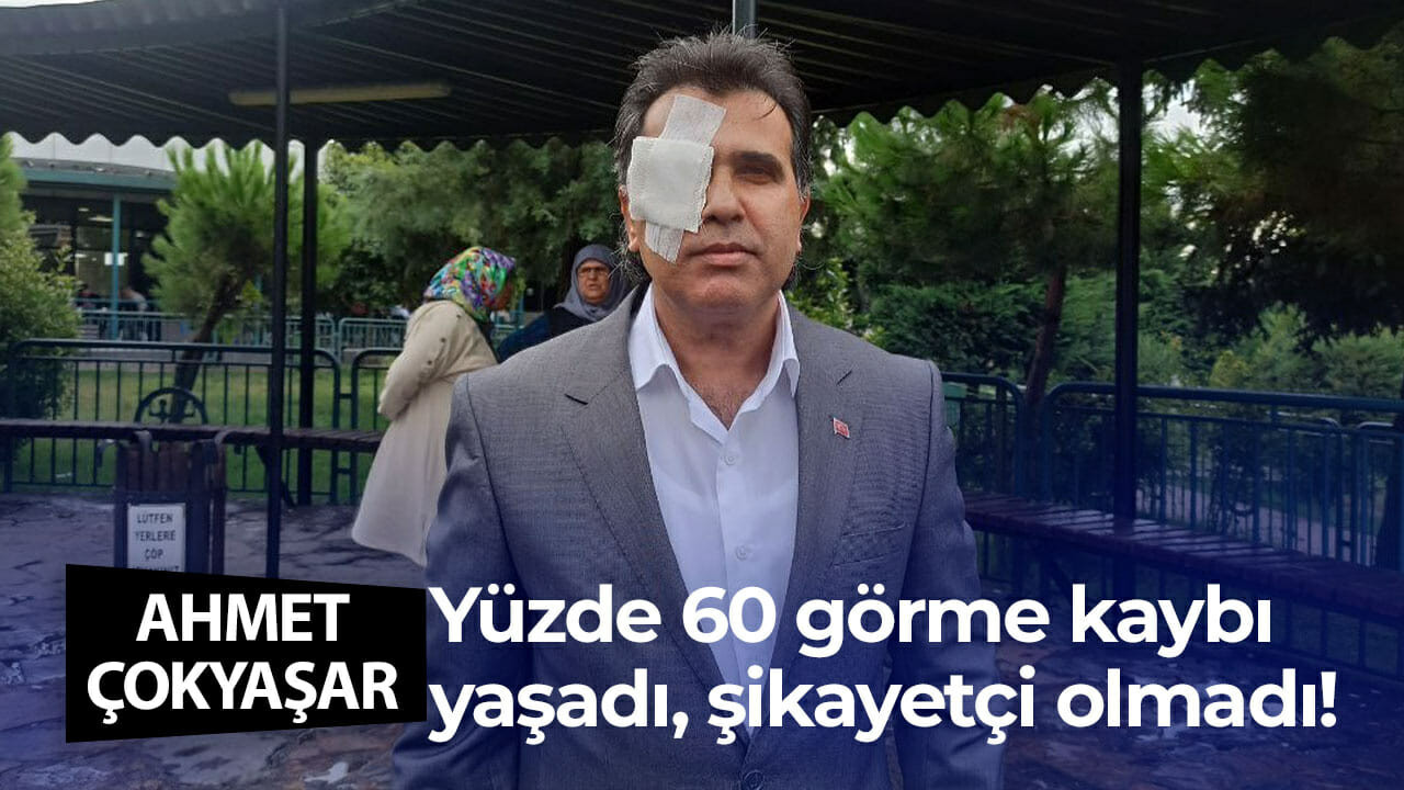 Yüzde 60 görme kaybı yaşadı, şikayetçi olmadı!