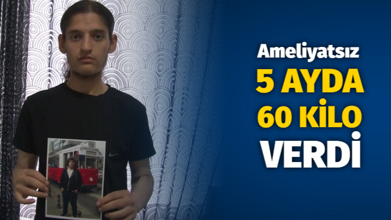 Ameliyatsız 5 ayda 60 kilo verdi