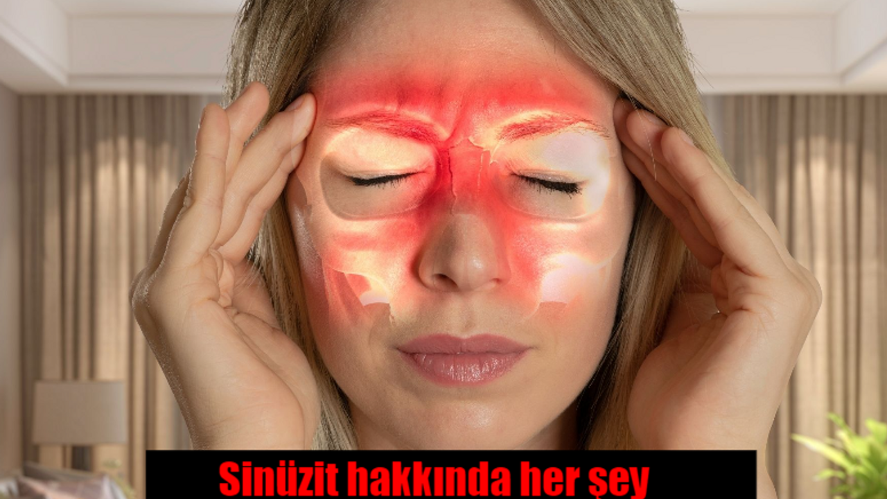 Sinüzit nedir? Sinüzit belirtileri nelerdir? Nasıl tedavi edilir?