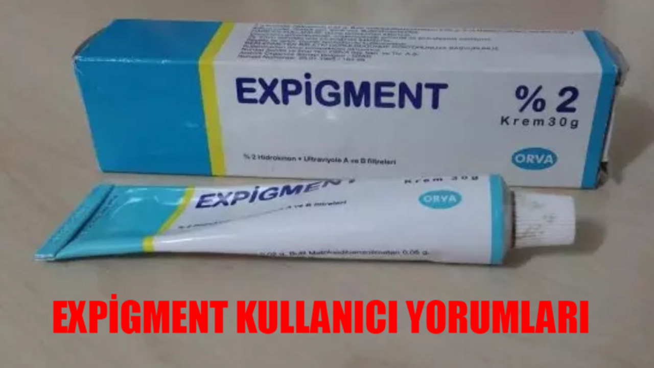 Expigment Kullananlar Yorumları: Expigment Nedir, Nasıl Kullanılır? Expigment Krem Ne İşe Yarar? Expigment Kullanıcı Yorumları