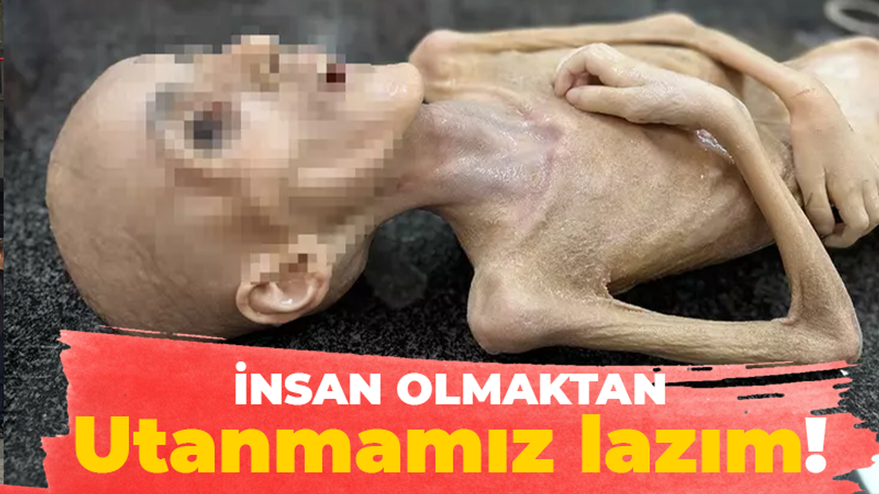 İnsan olmaktan utanmamız lazım!