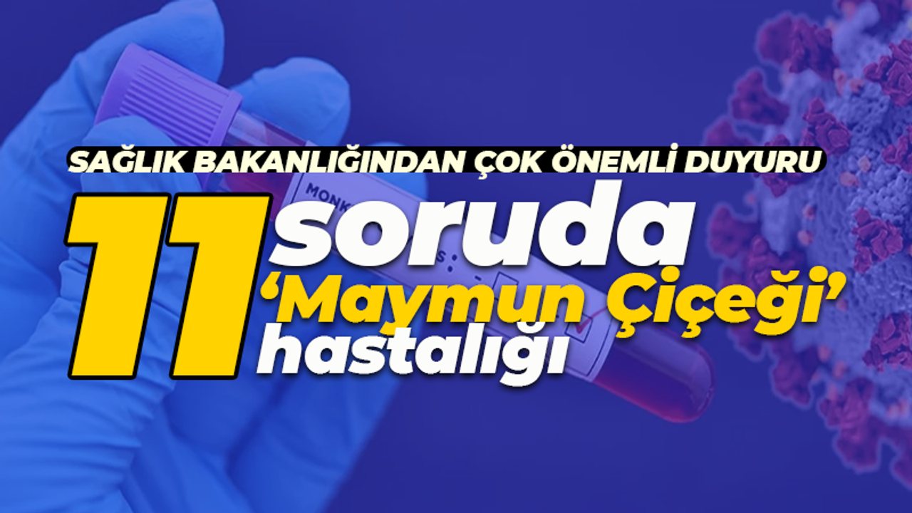 Sağlık Bakanlığı duyurdu: 11 soruda 'Maymun Çiçeği' nedir?