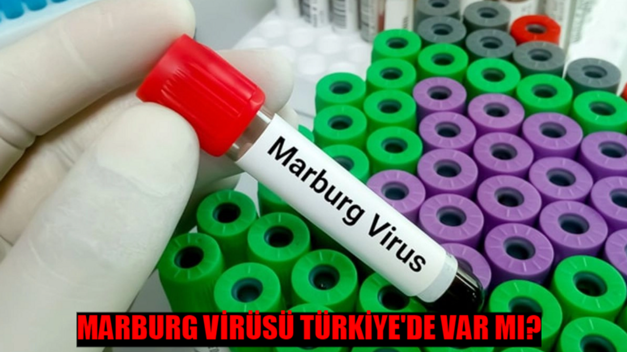 Marburg Virüsü Belirtileri Dünyayı Alarma Geçirdi! Marburg Virüsü Türkiye'de Var Mı? Marburg Virüsü Nasıl Bulaşır?