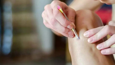 Kadınların korkulu rüyası: Batık lekeleri