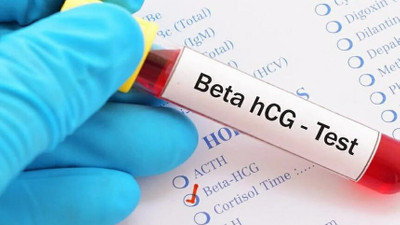 Beta HCG Testi: Hamilelik teşhisinde anahtar değerler