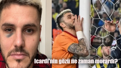 Mauro Icardi'nin gözü ne zaman, nasıl morardı?