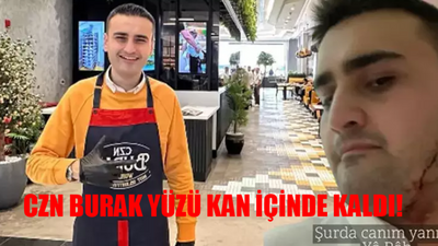 CZN Burak SON DAKİKA: CZN Burak Dayak Olayı Ne? CZN Burak Ne Oldu? CZN Burak Yüzü Kan Revan İçinde Kaldı! Meğer..