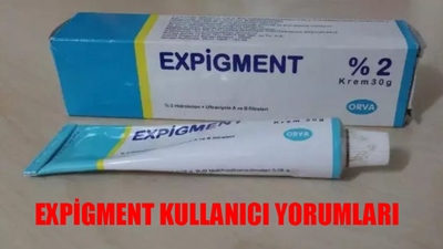 Expigment Kullananlar Yorumları: Expigment Nedir, Nasıl Kullanılır? Expigment Krem Ne İşe Yarar? Expigment Kullanıcı Yorumları