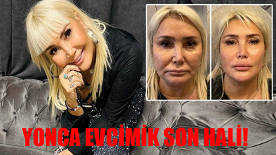 Yonca Evcimik Son Hali Görenlerin Gözleri Yuvalarından Fırladı! 60'lık Yoncimik 18'lik Çıtır Oldu! Yonca Evcimik Estetik Pozları Peş Peşe Geldi