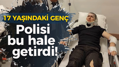 17 YAŞINDAKİ GENÇ Polisi bu hale getirdi!