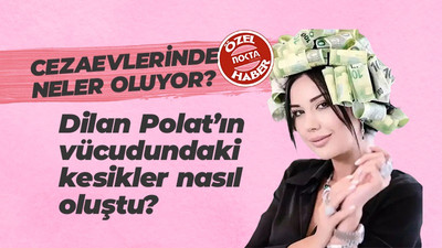 Cezaevlerinde neler oluyor? Dilan Polat’ın vücudundaki kesikler nasıl oluştu?