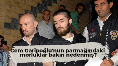 Cem Garipoğlu'nun parmağındaki morluklar bakın nedenmiş?