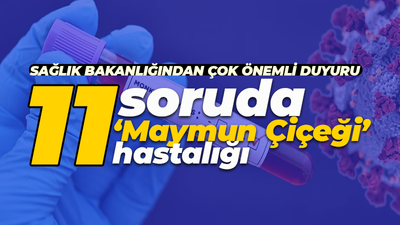 Sağlık Bakanlığı duyurdu: 11 soruda 'Maymun Çiçeği' nedir?