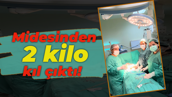 Midesinden 2 kilo kıl çıktı!