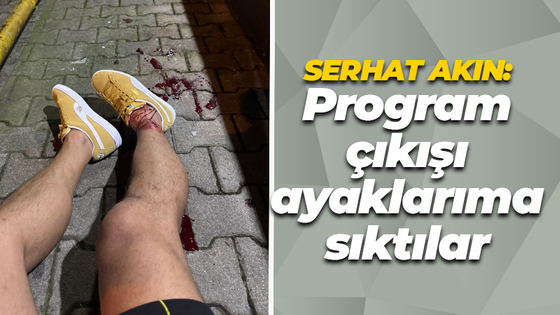 Serhat Akın program çıkışı saldırıya uğradı: Ayaklarıma sıktılar!